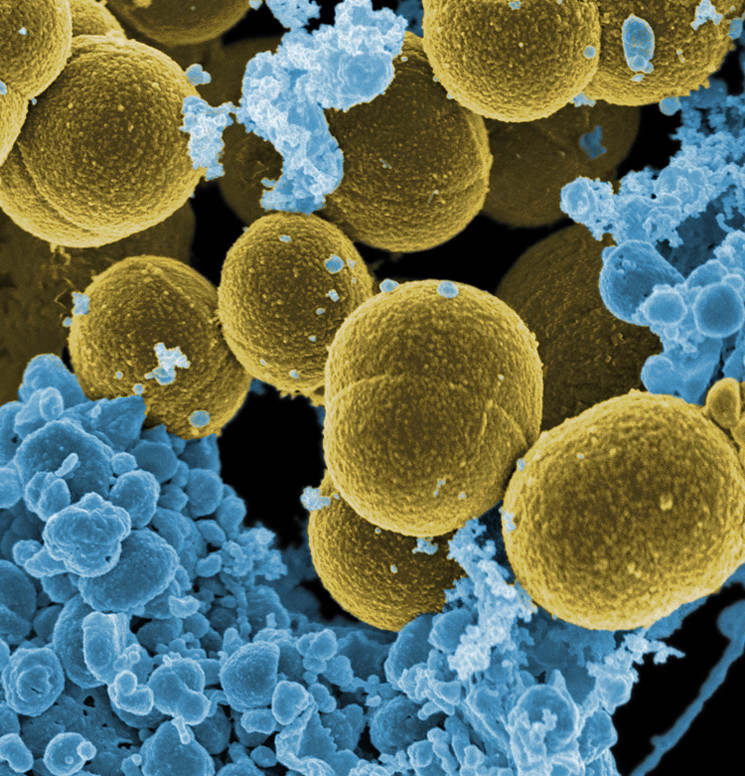 S. aureus bacteria escaping destruction by human white blood cells.