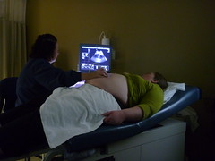Ultrasound showing the baby is "breech"