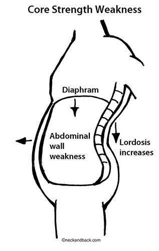 Lumbar Lordosis | Lower Back Pain | Core Strength Diagram | Colorado Spine Surgeon