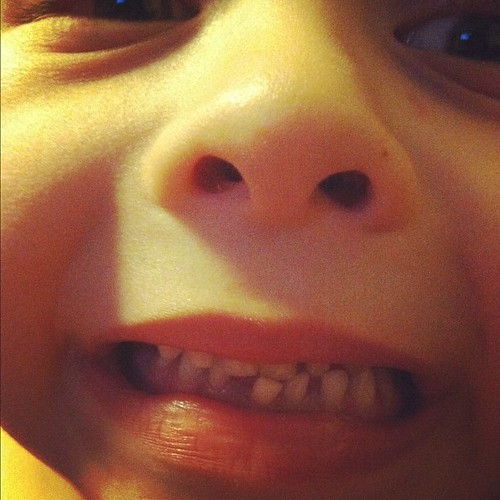 OMG we have our first wiggly tooth!