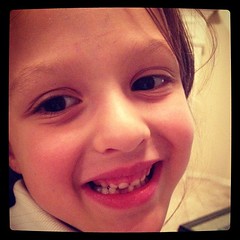 Lost her first tooth!