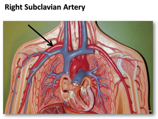 Right subclavian artery - The Anatomy of the Arteries Visual Guide