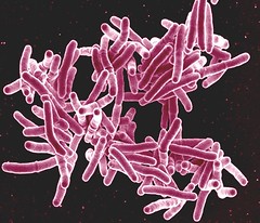 Photo:Mycobaterium tuberculosis By:Microbe World
